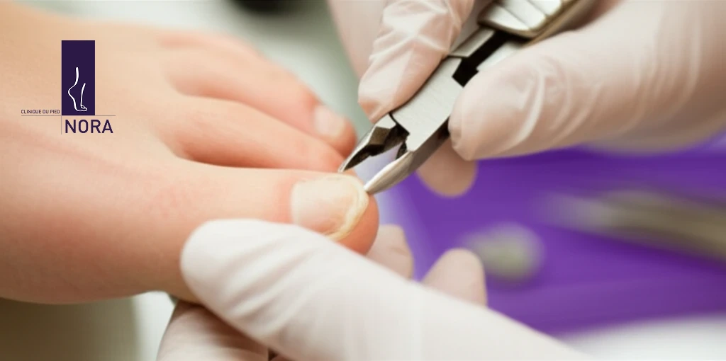 Soin de pied professionnel