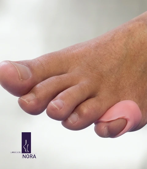 Conception orthoplastie sur mesure